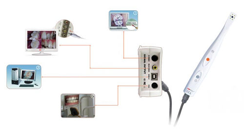 Intraoral camera - CamAssist-----HDI-300/400A - Handy Technologies - digital / CCD