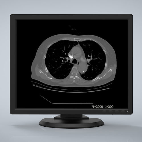 Diagnostic display - R190 - Nanjing Jusha Display Technology - 1280 x 1024 / 19" / LED-backlit