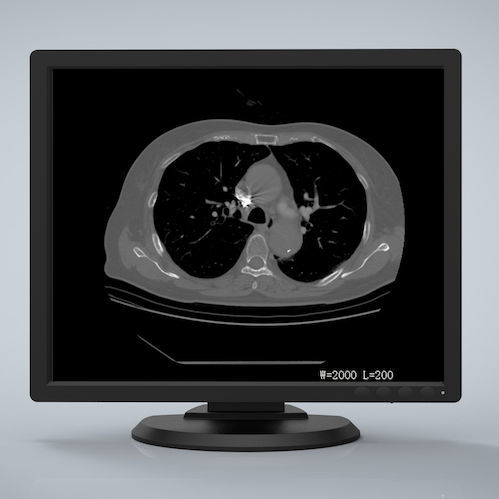 Medical display - R193G - Nanjing Jusha Display Technology - 1280 x 1024 / LCD / LED