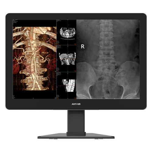 Medical display - C630G - Nanjing Jusha Display Technology - diagnostic / mammography / high-definition