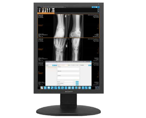 Measurement software module - iQ-4VIEW - IMAGE Information Systems - viewer / diagnostic / reporting