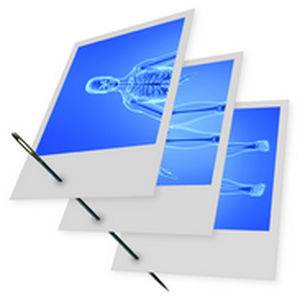 Data management software - Stitching  - IMAGE Information Systems - acquisition / multimodal image fusion / for orthopedic imaging
