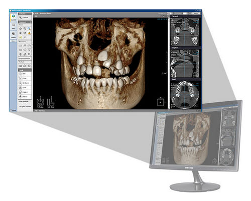 3D viewing software - Xelis 3D - LED Dental - analysis / for dental imaging / dental