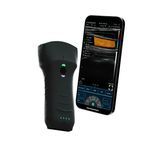 hand-held ultrasound system