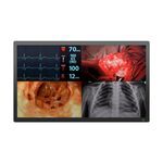 medical monitor