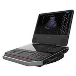 portable ultrasound system