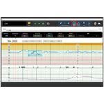 fetal monitor simulator