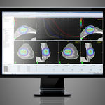 treatment planning software