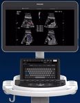 portable, with trolley ultrasound system