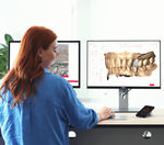 dental prosthesis CAD/CAM system