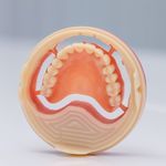 gingival medical model