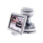 interferometry dry eye diagnosis system