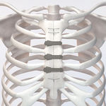 sternal closure bone cerclage wiring