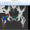 Orthopedic software - mediCAD Hectec GmbH - planning / hip / 3D