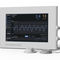 diaphragm excursion monitoring systemRESPINOR DXTRespinor DXT