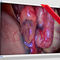 medical monitorEndoVue PlusNDS Surgical Imaging