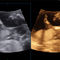 On Platform Ultrasound System Hera W Elite Samsung For Multipurpose Ultrasound Imaging