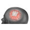 bovine calcaneal tendon dural substituteDuraMatrix Stryker