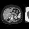 medical softwarePIQECanon Medical Systems Europe