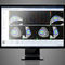 treatment planning softwareBrachyVision™Varian Oncology