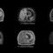 simulation software4D MR-RTPhilips Healthcare