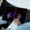 planning softwareIntuitive Intuitive Surgical