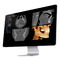 Medical software - Invivo - Anatomage - CT / PET / universal