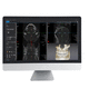 CT software / for dental imaging / dental / analysis