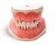 tooth model / gingival / for periodontics / training