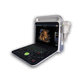 portable ultrasound system / for multipurpose ultrasound imaging / B/W / color doppler