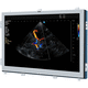 ultrasound imaging display / 1280 x 1024 / 19