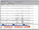 EMG software / for veterinary clinics / analysis