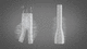 abdominal aorta vascular prosthesis / synthetic