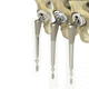 primary hip prosthesis / cemented