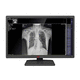 medical display / diagnostic / medical imaging / radiology