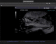 medical imaging PACS