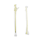 radius intramedullary nail / ulna / proximal fixation / distal fixation