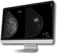 breast tomosynthesis medical software / analysis / interpretation / for breast cancer screening