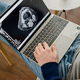 PACS cloud computing solution / medical / RIS / reporting