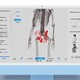 balance evaluation system / posture / kinematic analysis