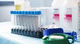 typhoid test kit / for toxoplasmosis / syphilis / COVID-19