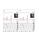 analysis software / for MRI