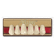 acrylic dental prosthesis / anterior teeth / posterior teeth
