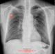 artificial intelligence software / visualization / diagnostic / CT