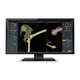 analysis software / diagnostic / acquisition / treatment