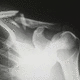 image analysis software / for fracture detection / medical / hospital