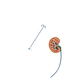 ureteral access sheath / renal / steerable / atraumatic