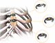 sternal closure bone cerclage wiring / metalic monofilament