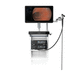 wide-angle video gastroscope