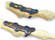 foot phalange arthrodesis plate / non-locking / metallic